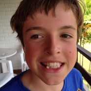 Tooth Fairy Economics